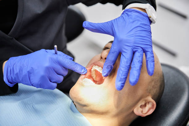 Best Emergency Wisdom Teeth Removal in New Hope, MS